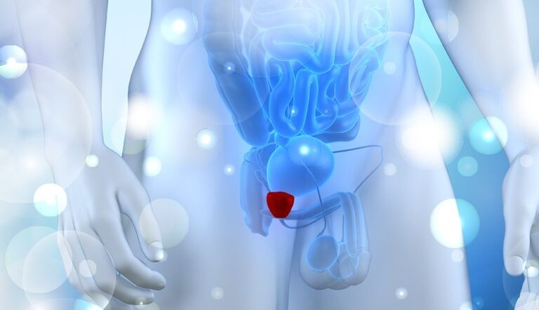 Vesiculite in men
